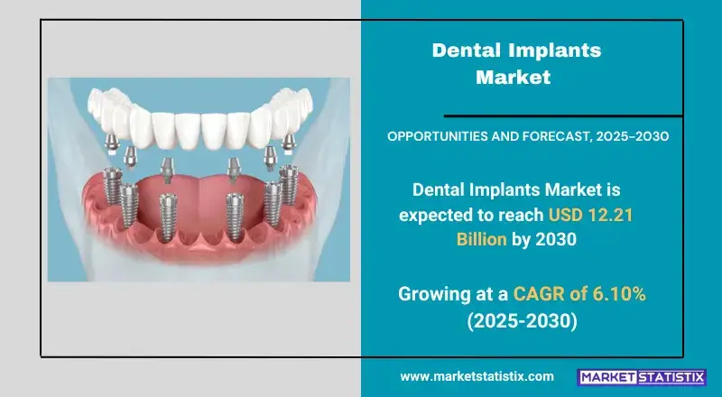 Dental Implants Market Industry Dynamics, Market Size, And Opportunity