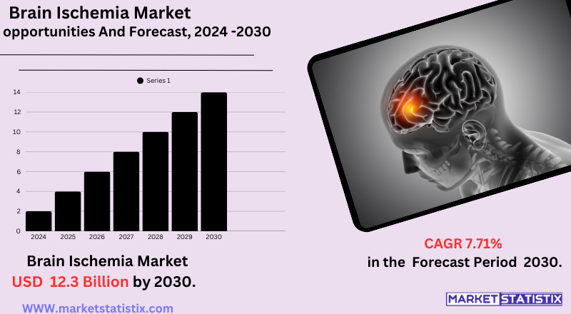 Infographic showing treatment trends for brain ischemia disorders